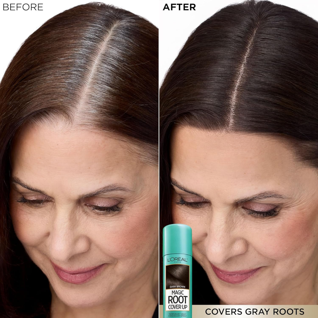 L'Oréal Paris Magic Retouch Root Concealer Spray – Instant Gray Coverage in 3 Seconds – Temporary Root Touch-Up Spray, Lasts Until Shampoo – Covers Gray Roots & Sparse Areas – Ammonia-Free, Transfer-Resistant