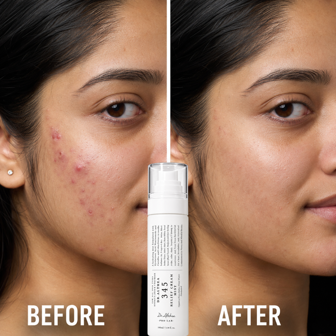 Dr. Althea 345 Relief Cream Mist – Hydrating Dual-Layer Face Mist – Soothes Redness, Revives Dullness & Sets Makeup