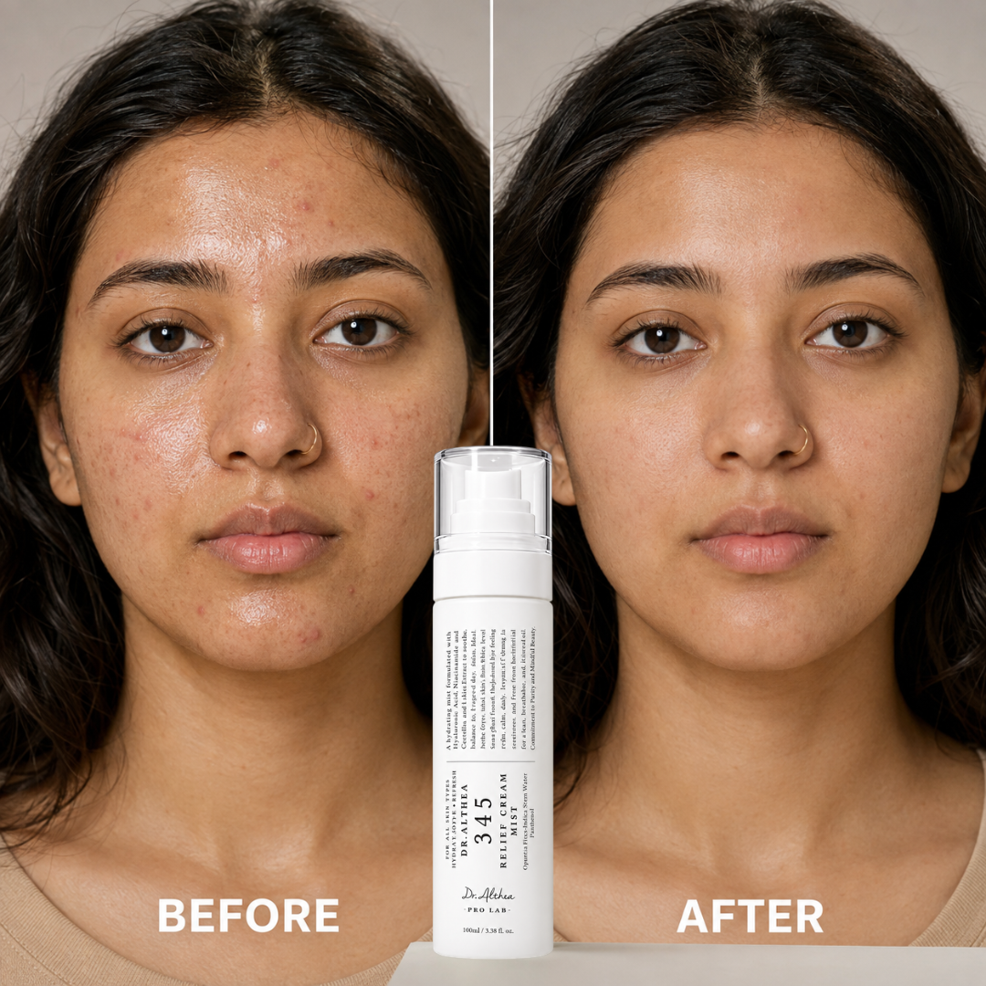 Dr. Althea 345 Relief Cream Mist – Hydrating Dual-Layer Face Mist – Soothes Redness, Revives Dullness & Sets Makeup