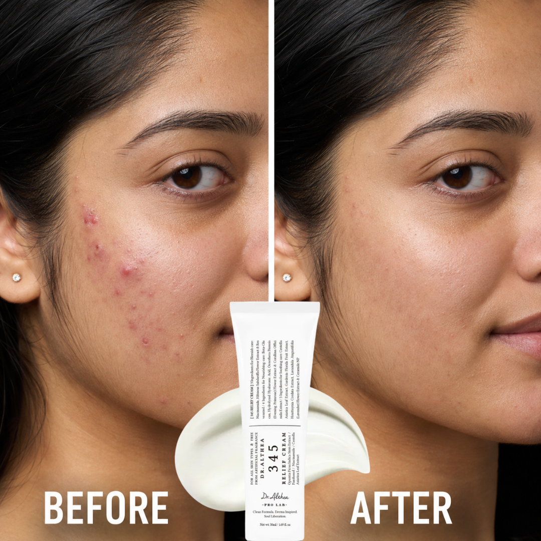 Dr. Althea 345 Relief Duo Set (Buy 1 Get 1 FREE) – Relief Cream & Makeup Mist – Oily & Acne-Prone Care – Hydrates & Calms Redness