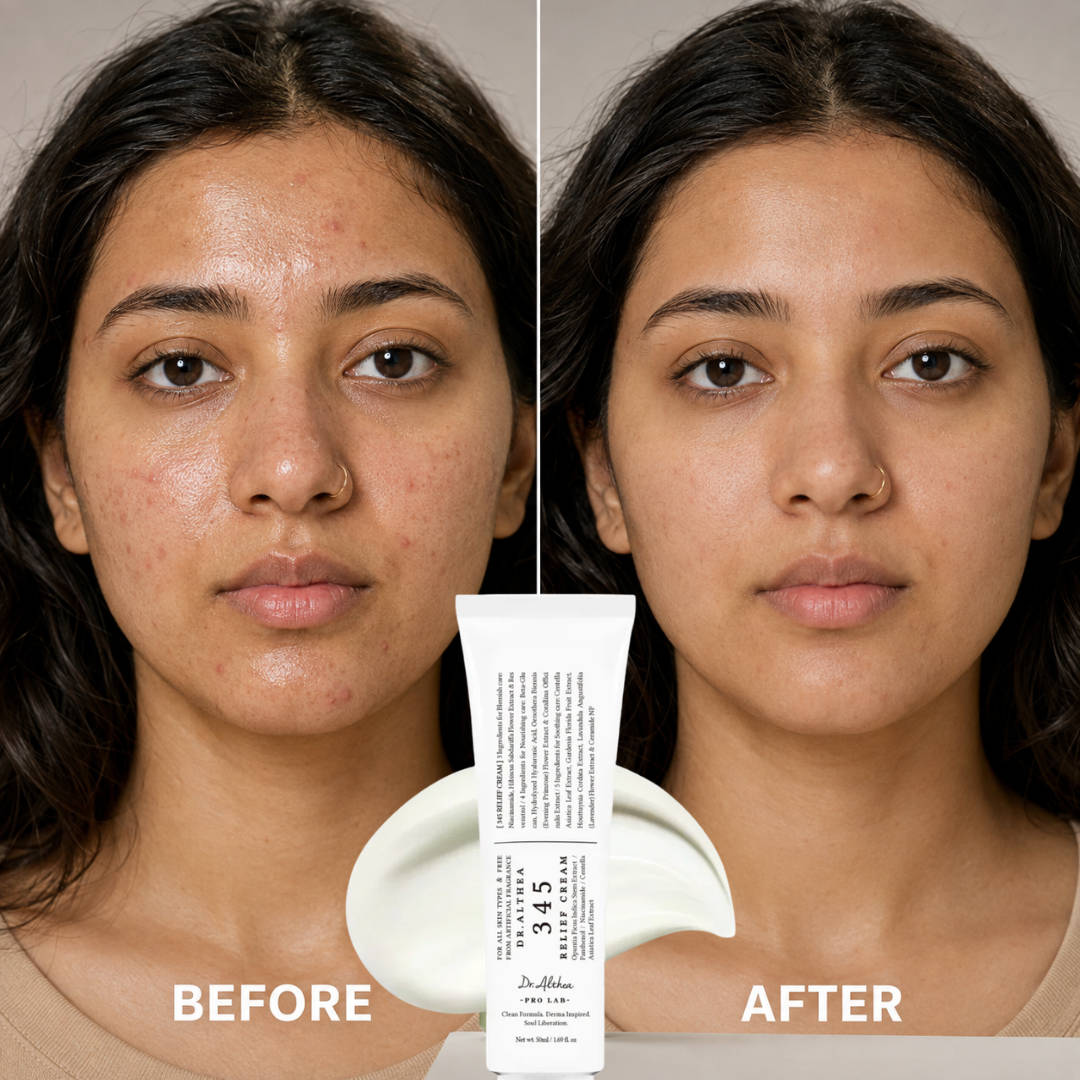 Dr. Althea 345 Relief Duo Set (Buy 1 Get 1 FREE) – Relief Cream & Makeup Mist – Oily & Acne-Prone Care – Hydrates & Calms Redness