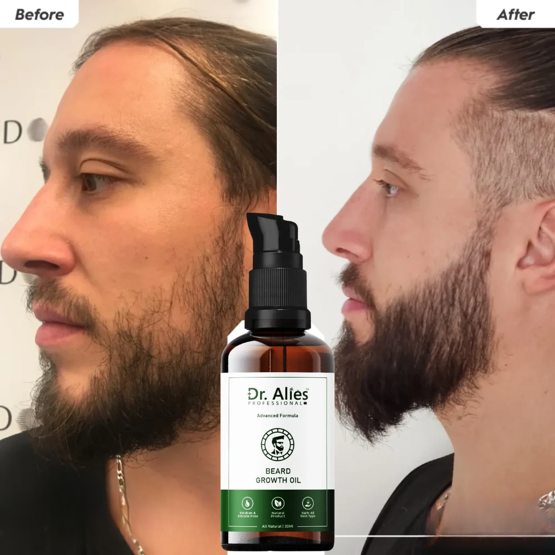 Dr. Alies Professional Beard Growth Oil – 50% OFF – Thicker, Fuller, Stronger Beard – Fills Patchy Areas, Promotes Natural Beard Growth – With Castor Oil, Sweet Almond Oil & Vitamin E
