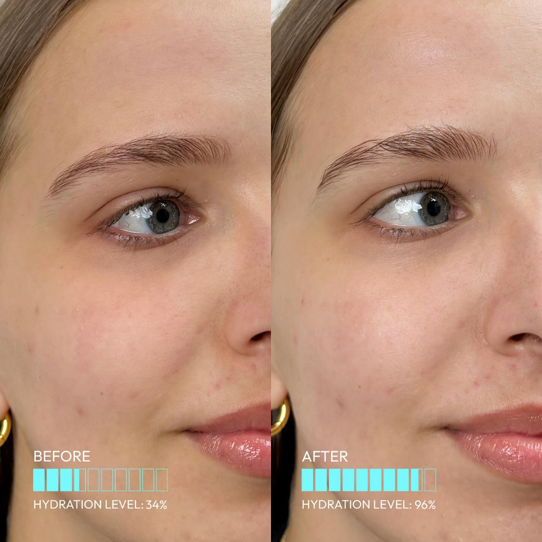 VT Cosmetics PDRN Essence Stick Balm | 1-Second Glow with Plant-Based PDRN, Collagen & Ceramide | Wrinkle Care, Firming & Instant Hydration