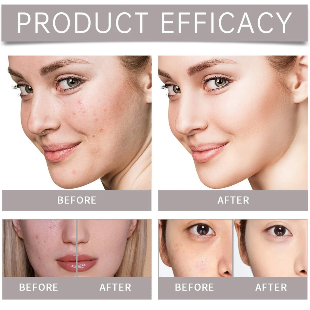 Madeca Cream Time Reverse | Blemish, Wrinkle & Dark Spot Repair | Imported from Korea