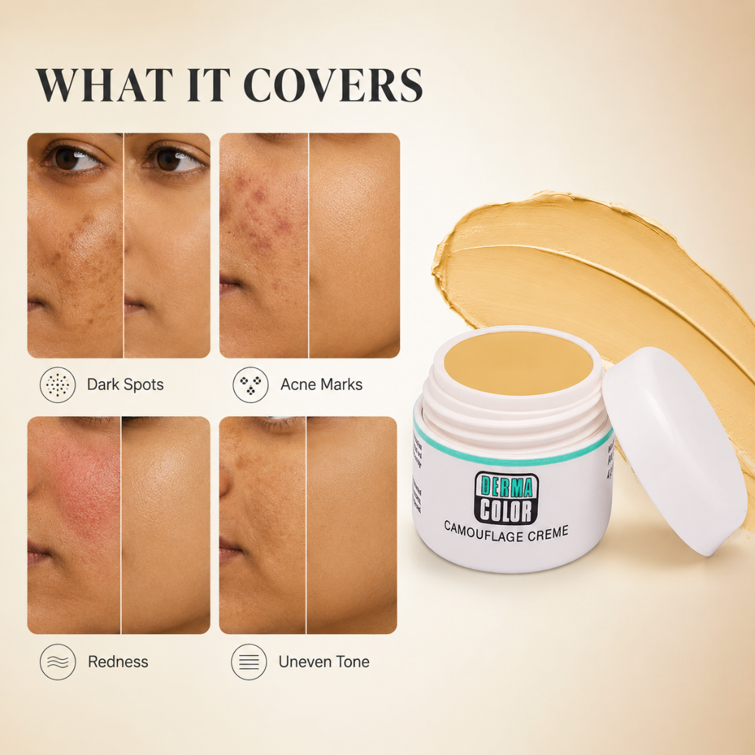Derma Color Camouflage Crème – High Coverage, Natural Look – Covers Discoloration, Acne Marks, Redness & Uneven Tone – Buildable, Blendable Finish – Targeted Camouflage