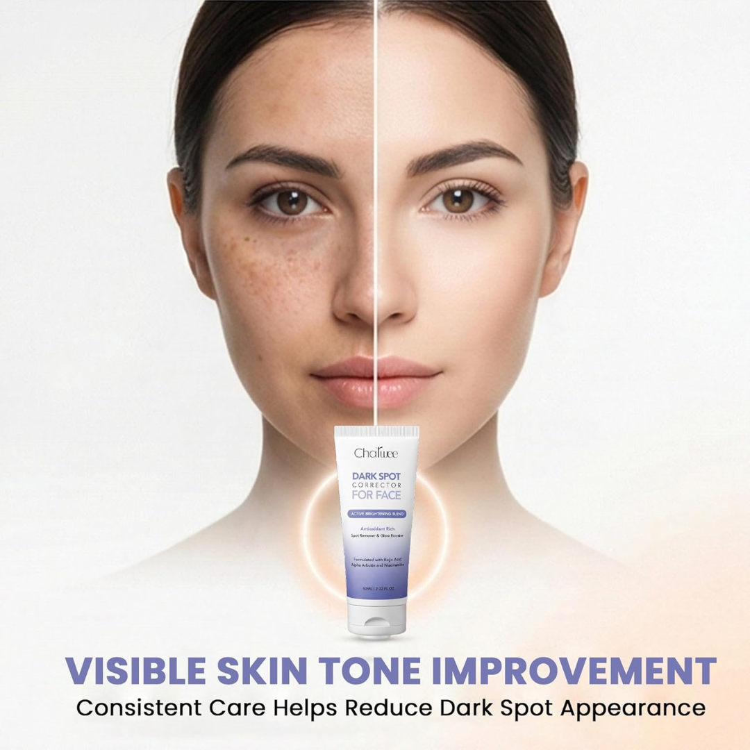 Charwee Dark Spot Corrector for Face – Clearer Skin, More Confidence – Targets Hyperpigmentation, Melasma, Acne Marks & Dark Spots