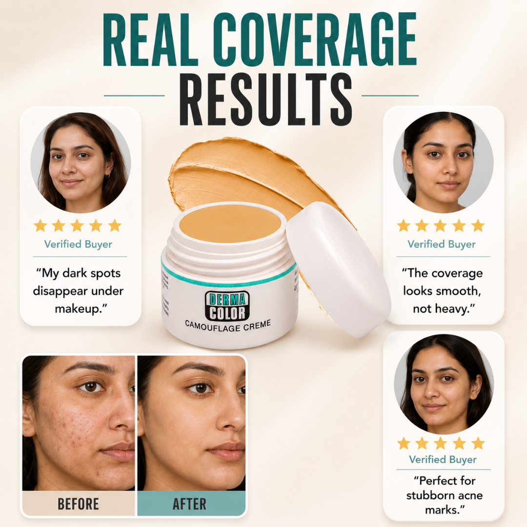 Derma Color Camouflage Crème – High Coverage, Natural Look – Covers Discoloration, Acne Marks, Redness & Uneven Tone – Buildable, Blendable Finish – Targeted Camouflage