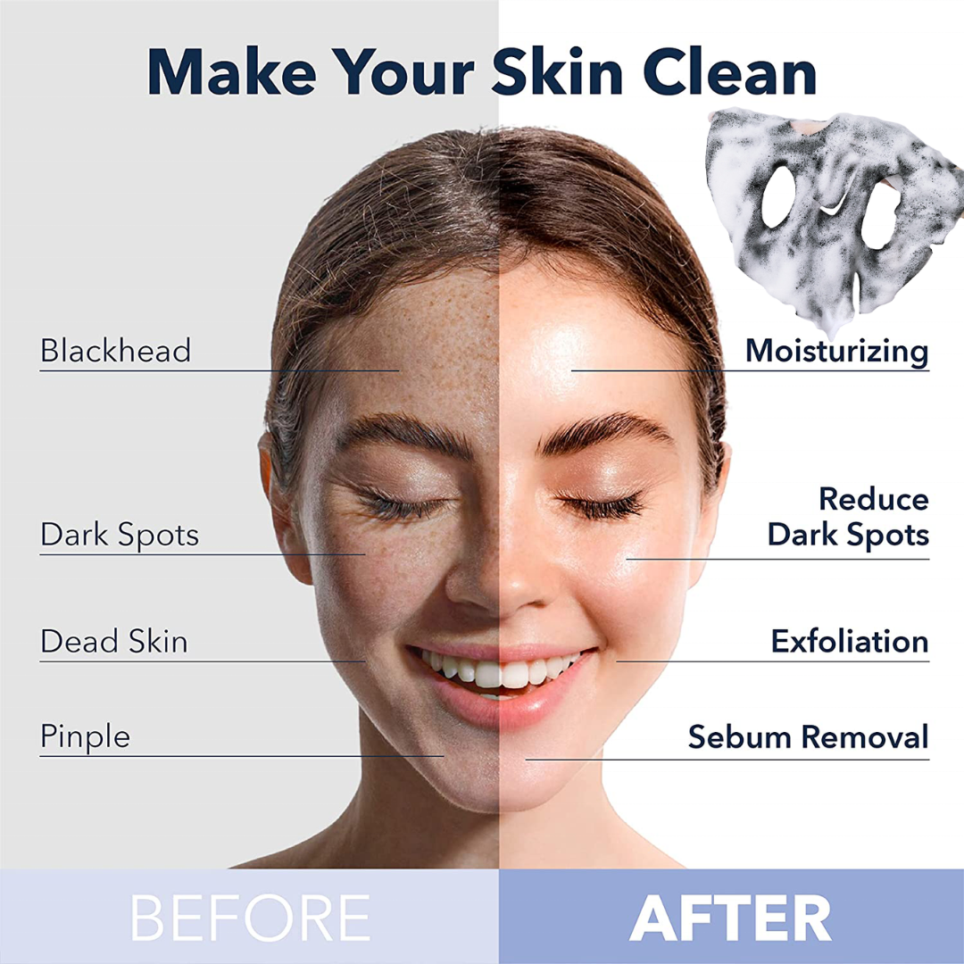 Bio Cos O2 Bubble Charcoal Black Mask | Self-Foaming Deep Pore Cleanser for Blackheads, Oil & Dull Skin