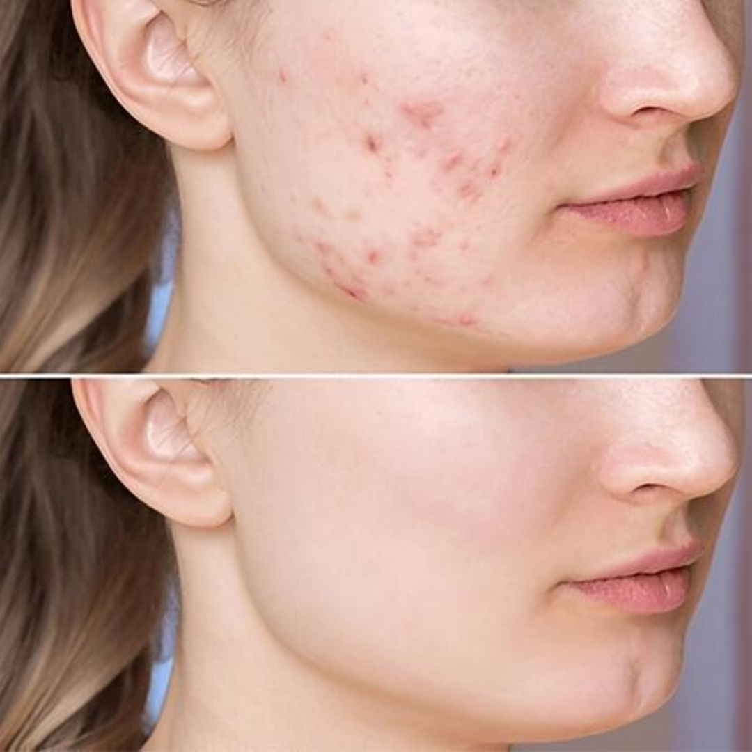 Purito SEOUL Retinol Retinal 2000 NAD+ Serum | Wrinkle Repair | Fades Dark Spots | Firms & Smooths